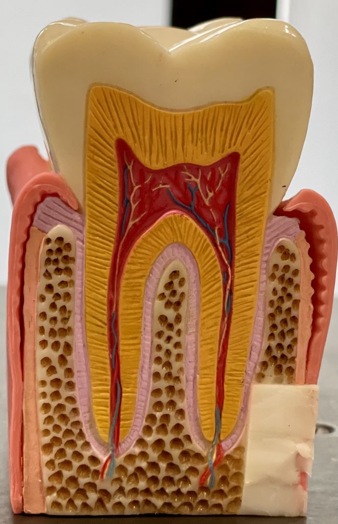 Endodontie ...?          A quoi ça sert ?
