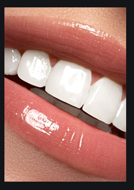 Dents saines pour un sourire esthétique 😁