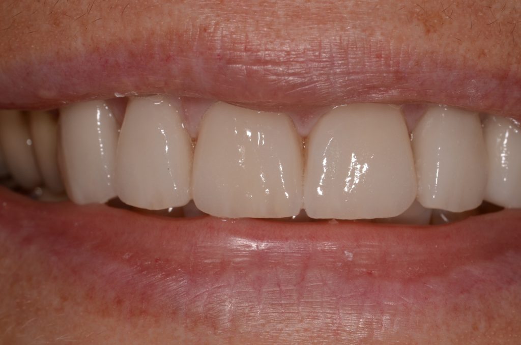 Esthétique dentaire