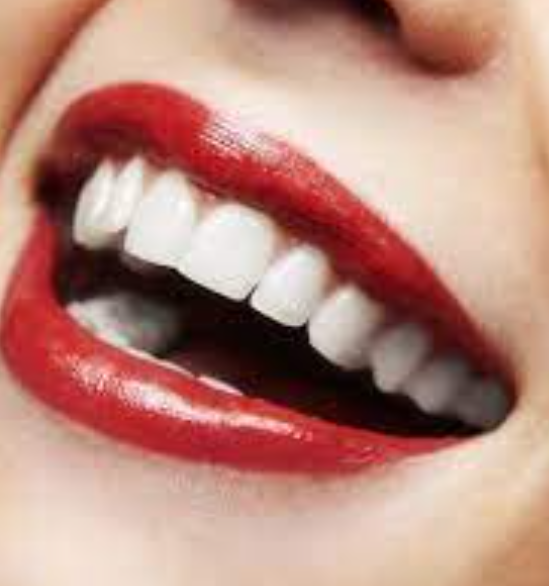 Esthétique du sourire