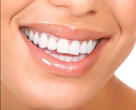 Rajeunissement du sourire